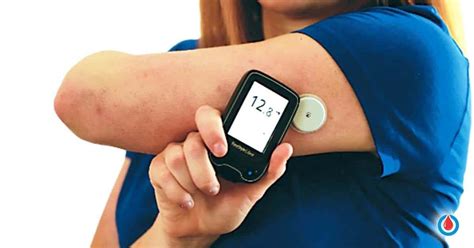 diabetes test machine|blood sugar monitor without finger pricks.